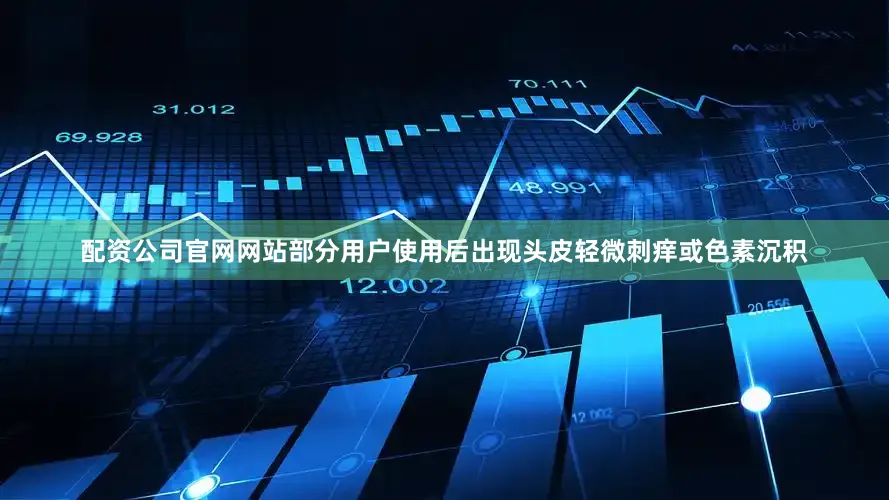 配资公司官网网站部分用户使用后出现头皮轻微刺痒或色素沉积